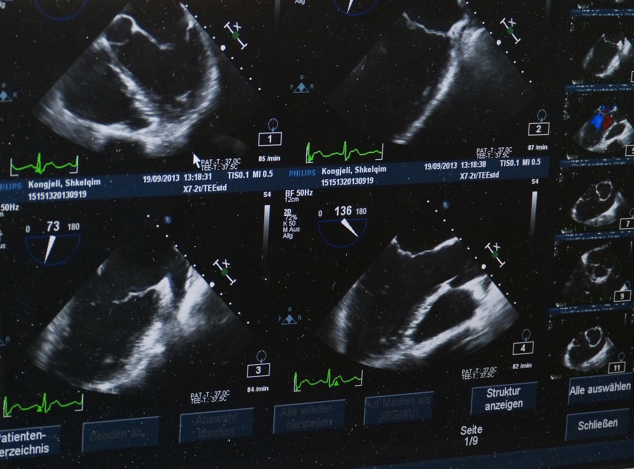 Zadbaj o zdrowie swojej wątroby - poznaj zalety nowoczesnych badań diagnostycznych