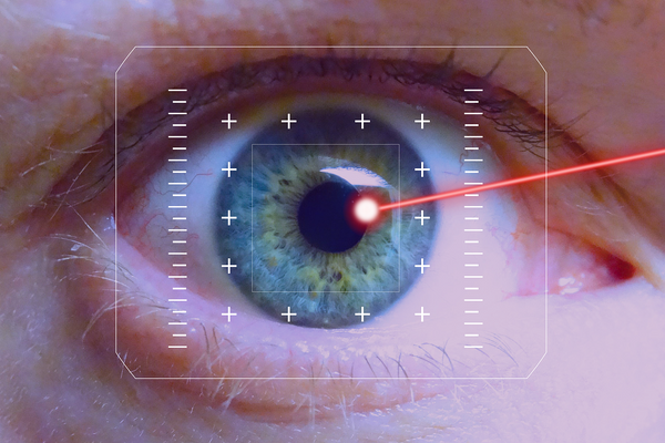 Zrozumieć metodę likwidacji zmian skórnych - laser naczynkowy