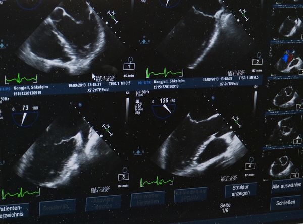 Zadbaj o zdrowie swojej wątroby - poznaj zalety nowoczesnych badań diagnostycznych